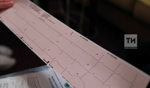 Табиблар холестеринны гел контрольдә тотарга кирәклеген искәртте