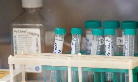 Россиядә коронавирус инфекциясен ачыклау өчен 12,3 миллионнан артык тест үткәрелгән