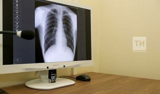 Татарстанда яман шешнең иң киң таралган биш төре билгеле: Былтыр рекорд санга чыктык